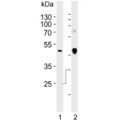 Western blot testing of human 1) A549 and 2) plasma lysate with Clusterin antibody. 