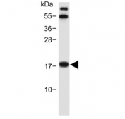 Western blot testing of mouse small intestine lysate with NUDT15 antibody. Predicted molecular weight ~19 kDa.