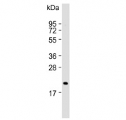Western blot testing of human HuTu-80 cell lysate with NUDT15 antibody. Predicted molecular weight ~19 kDa.