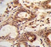 IHC testing of FFPE human breast tissue with NUDT15 antibody. HIER: steam section in pH6 citrate buffer for 20 min and allow to cool prior to staining.