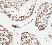 IHC testing of FFPE human testis tissue with IFITM5 antibody. HIER: steam section in pH6 citrate buffer for 20 min and allow to cool prior to staining.