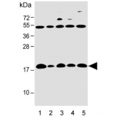 Western blot testing of human 1) T-47D, 2) PC3, 3) SW480, 4) HT-29 and 5) PANC-1 cell lysate with IFITM5 antibody. Predicted molecular weight: ~14 kDa.