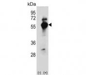 Western blot testing of (left) non-transfected and (right) transfected 293 cell lysate with DARS1 antibody. Predicted molecular weight ~57 kDa.