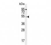 Western blot testing of human Jurkat cell lysate with DARS1 antibody. Predicted molecular weight ~57 kDa.