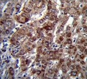 IHC testing of FFPE human liver tissue with DARS1 antibody. HIER: steam section in pH6 citrate buffer for 20 min and allow to cool prior to staining.