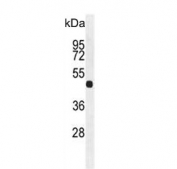 Western blot testing of mouse heart lysate with Fibroleukin antibody. Predicted molecular weight: 50-70 kDa depending on level of glycosylation.