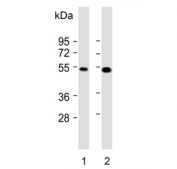 Western blot testing of human 1) HeLa and 2) NCI-H460 cell lysate with Fibroleukin antibody. Predicted molecular weight: 50-70 kDa depending on level of glycosylation.