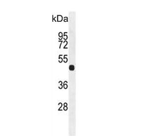 Western blot testing of mouse heart lysate with Fibroleukin antibody. Predicted molecular weight: 50-70 kDa depending on level of glycosylation.