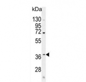 Western blot testing of mouse bladder lysate with C12orf29 antibody. Predicted molecular weight ~37 kDa.