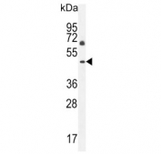 Western blot testing of human NCI-H460 cell lysate with C12orf29 antibody. Predicted molecular weight ~37 kDa.