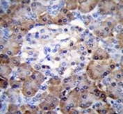 IHC testing of FFPE human pancreas tissue with TIMP-1 antibody. HIER: steam section in pH6 citrate buffer for 20 min and allow to cool prior to staining.