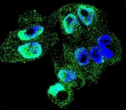 Immunofluorescent staining of fixed and permeabilized human A2058 cells with TIMP-1 antibody (green) and DAPI nuclear stain (blue).