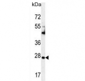 Western blot testing of human CCRF-CEM cell lysate with TIMP-1 antibody. Expected molecular weight: 23-28 kDa depending on the level of glycosylation.