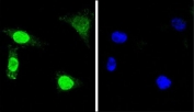 Immunofluorescent staining of fixed and permeabilized human HeLa cells with WDR70 antibody (green) and DAPI nuclear stain (blue).