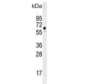 Western blot testing of human HeLa cell lysate with WDR70 antibody. Expected molecular weight ~70 kDa.