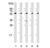 Western blot testing of human 1) HepG2, 2) Li-7, 3) U-87 MG, 4) testis and 5) mouse testis lysate with DHCR7 antibody. Predicted molecular weight ~54 kDa.