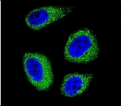 Immunofluorescent staining of fixed and permeabilized human MCF7 cells with DHCR7 antibody (green) and DAPI nuclear stain (blue).