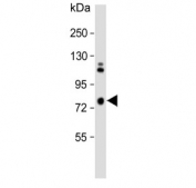 Western blot testing of human A431 cell lysate with Sciellin antibody. Predicted molecular weight ~77 kDa.