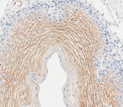 IHC testing of FFPE human esophagus tissue with Sciellin antibody. HIER: steam section in pH9 EDTA for 20 min and allow to cool prior to staining.