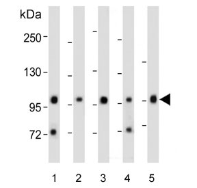 Western blot testing of human 1) SK-BR-3, 2) SH-SY5Y, 3) MCF7, 4) HL60 and 5) rat brain lysate with Protocadherin 20 antibody. Predicted molecular weight ~105 kDa.