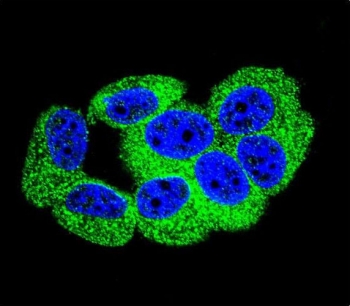 Immunofluorescent staining of fixed and permeabilized human MCF7 cells with Protocadherin 20 antibody (green) and DAPI nuclear stain (blue).