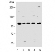 Western blot testing of human 1) SK-BR-3, 2) SH-SY5Y, 3) MCF7, 4) HL60 and 5) rat C6 cell lysate with Protocadherin 20 antibody. Predicted molecular weight ~105 kDa.