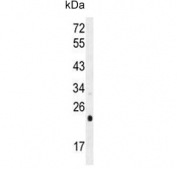 Western blot testing of human HeLa cell lysate with UQCRFS1 antibody. Predicted molecular weight ~30 kDa.