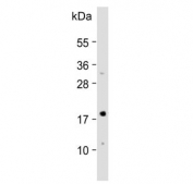 Western blot testing of human RPMI-8226 cell lysate with CDKN2A antibody. Predicted molecular weight ~16 kDa.
