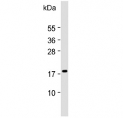 Western blot testing of human HeLa cell lysate with CDKN2A antibody. Predicted molecular weight ~16 kDa.