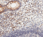 IHC testing of FFPE human epityphlon tissue with CDKN2A antibody. HIER: steam section in pH6 citrate buffer for 20 min and allow to cool prior to staining.