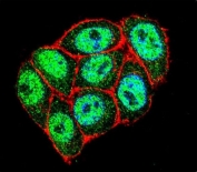 Immunofluorescent staining of fixed and permeabilized human HeLa cells with CDKN2A antibody (green), DAPI nuclear stain (blue) and anti-Actin (red).