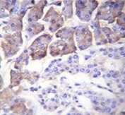 IHC testing of FFPE human pancreas tissue with Carboxypeptidase B antibody. HIER: steam section in pH6 citrate buffer for 20 min and allow to cool prior to staining.