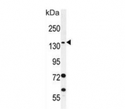 Western blot testing of human HL60 cell lysate with SPECC1L antibody. Predicted molecular weight ~125 kDa.