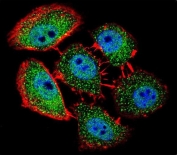 Immunofluorescent staining of fixed and permeabilized human U-251 MG cells with SPECC1L antibody (green), DAPI nuclear stain (blue) and anti-Actin (red).