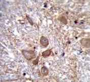 IHC testing of FFPE human brain tissue with SPECC1L antibody. HIER: steam section in pH6 citrate buffer for 20 min and allow to cool prior to staining.