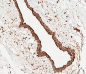 IHC testing of FFPE human breast tissue with Acid Sphingomyelinase antibody. HIER: steam section in pH9 EDTA for 20 min and allow to cool prior to staining.