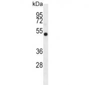 Western blot testing of human K562 cell lysate with IDO2 antibody. Predicted molecular weight ~47 kDa.