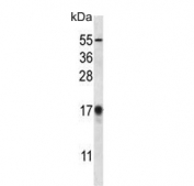 Western blot testing of human HepG2 cell lysate with MAP1LC3B antibody. Predicted molecular weight ~15 kDa.