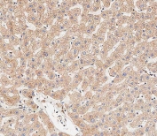 IHC testing of FFPE human liver tissue with MAP1LC3B antibody. HIER: steam section in pH9 EDTA for 20 min and allow to cool prior to staining.