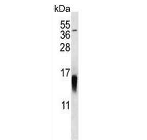 Western blot testing of mouse NIH 3T3 cell lysate with MAP1LC3B antibody. Predicted molecular weight ~15 kDa.