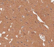 IHC testing of FFPE human brain tissue with MAP1LC3B antibody. HIER: steam section in pH9 EDTA for 20 min and allow to cool prior to staining.