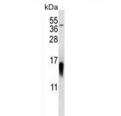 Western blot testing of mouse NIH 3T3 cell lysate with MAP1LC3B antibody. Predicted molecular weight ~15 kDa.