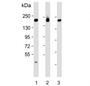 Western blot testing of human 1) MCF7, 2) SK-BR-3 and 3) ThP1 cell lysate with PREX1 antibody. Predicted molecular weight ~186 kDa.