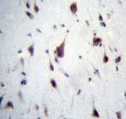 IHC testing of FFPE human brain tissue with PREX1 antibody. HIER: steam section in pH6 citrate buffer for 20 min and allow to cool prior to staining.