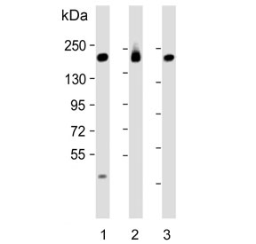 Western blot testing of human 1) MCF7, 2) SK-BR-3 and 3) ThP1 cell lysate with PREX1 antibody. Predicted molecular weight ~186 kDa.