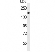 Western blot testing of human NCI-H460 cell lysate with PREX1 antibody. Predicted molecular weight ~186 kDa.