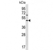 Western blot testing of human MDA-MB-435 cell lysate with Keratocan antibody. Predicted molecular weight ~41 kDa.