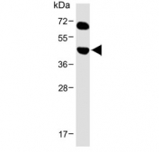 Western blot testing of human skeletal muscle lysate with Keratocan antibody. Predicted molecular weight ~41 kDa.