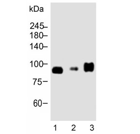 Western blot testing of human 1) LNCaP, 2) U-2 OS and 3) MCF7 cell lysate with CD276 antibody. Expected molecular weight: 57-110 kDa depending on level of glycosylation.