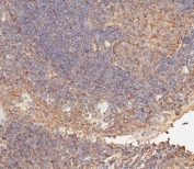 IHC testing of FFPE human tonsil tissue with CD276 antibody. HIER: steam section in pH9 EDTA for 20 min and allow to cool prior to staining.